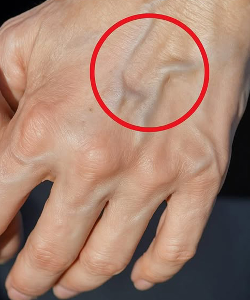 If you have visible veins, it means you are...
